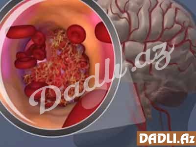 Beyini cavanlaşdıran 3 MƏHSUL