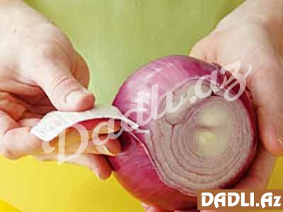 Əlinizdən soğan iyi gəlməyəcək