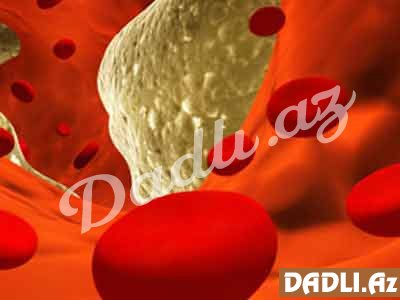 Damarları təmizləyən qidalar