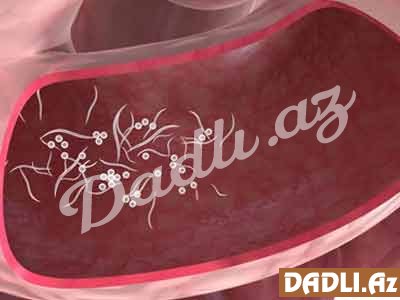 Orqanizmi qurdlardan təmizləyən 3 MƏHSUL